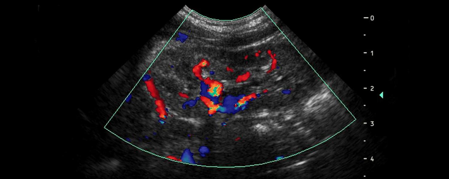 Ecografías Talcahuano