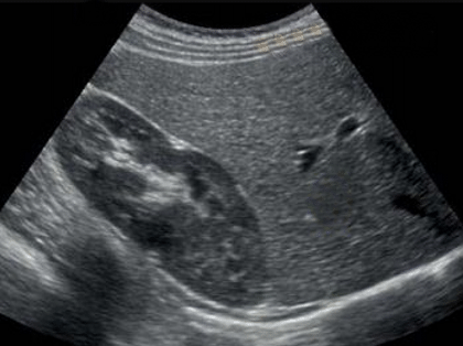 Imagenes de Ecografías